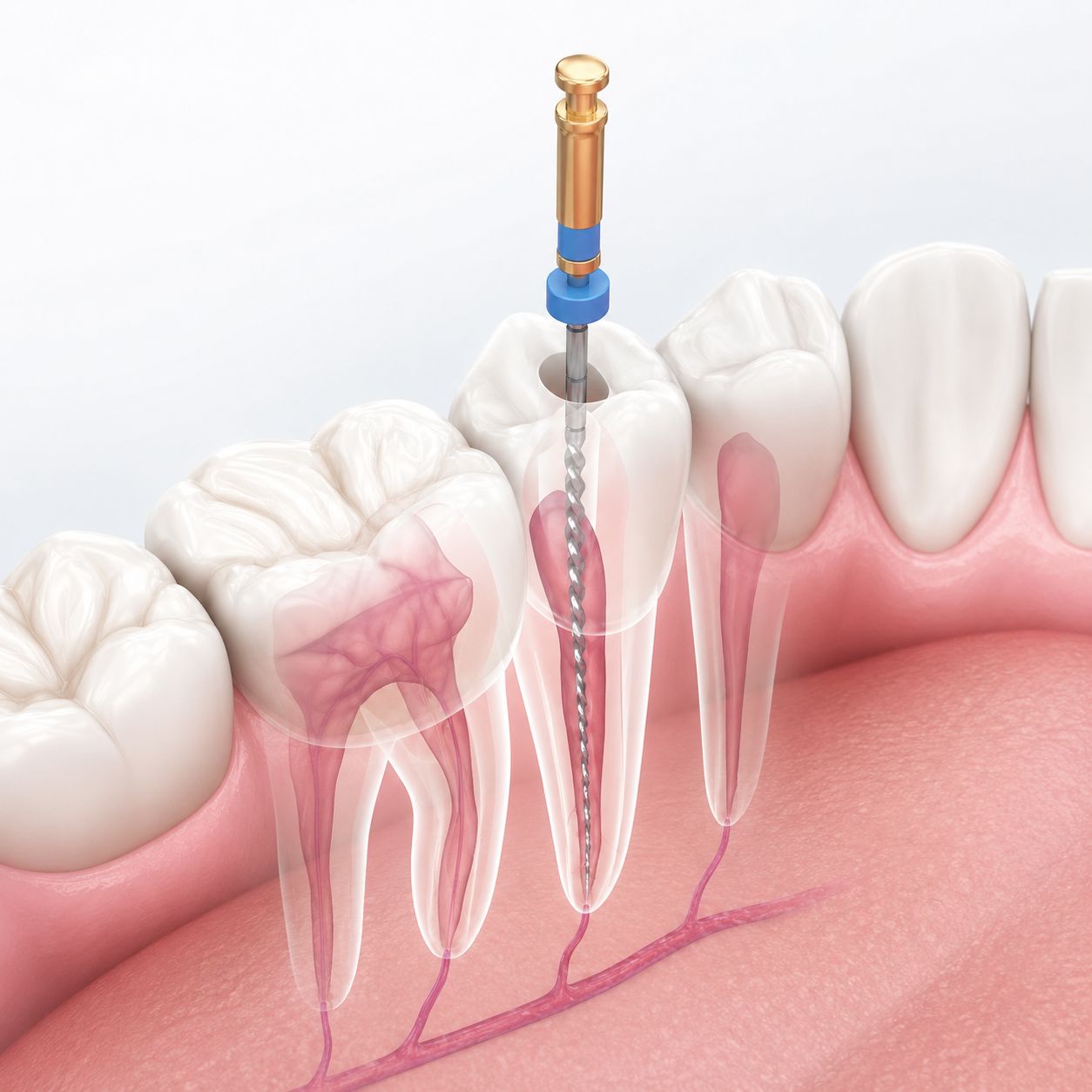 Endodoncia
